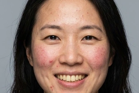 Original: Professional portrait retouch